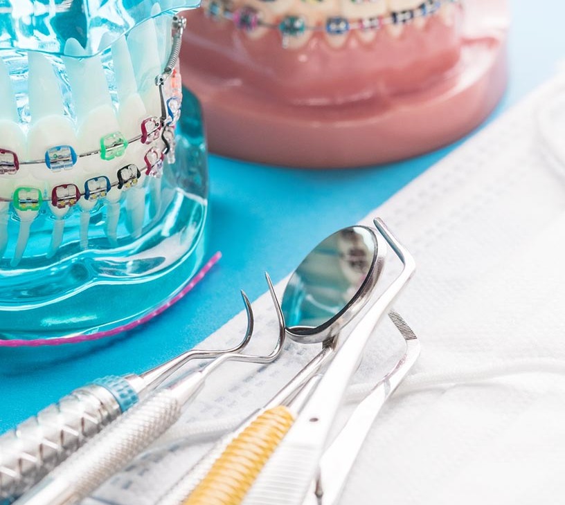 Orthodontic Supplies Market Analysis, Size, and Forecast 2026-2030: North America (US, Canada, and Mexico), Europe (Germany, UK, and France), APAC (China, India, and Japan), South America (Brazil, Argentina, and Colombia), Middle East and Africa (UAE, South Africa, and Saudi Arabia), Asia, Rest of World (ROW)