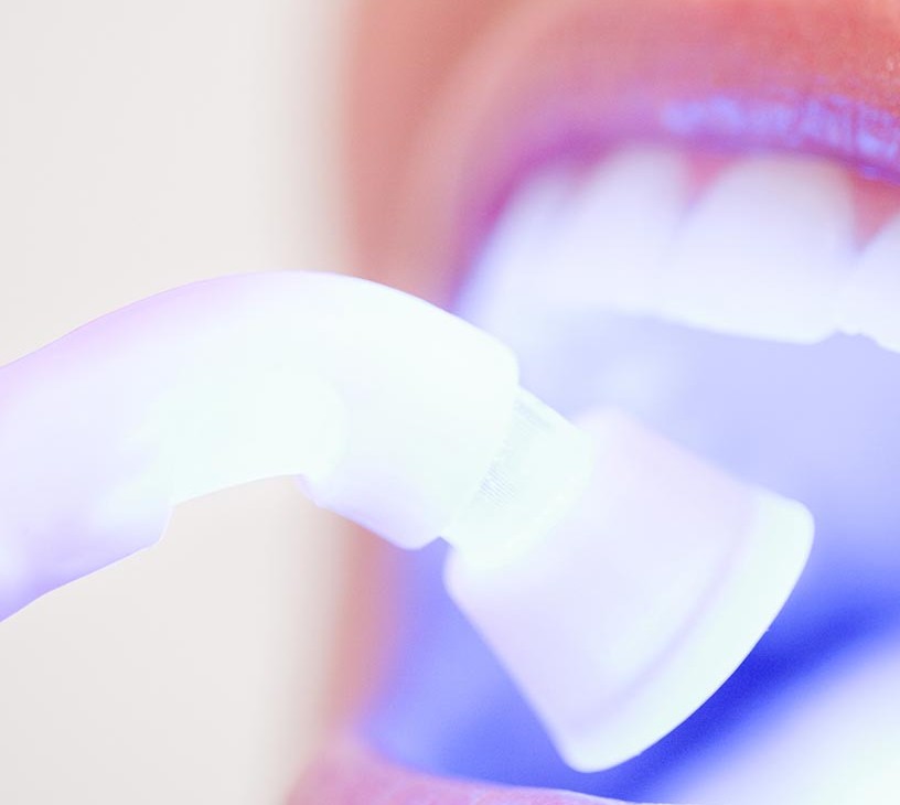 Teeth Whitening Market Analysis, Size, and Forecast 2026-2030: North America (US, Canada, and Mexico), APAC (China, India, and Japan), Europe (Germany, UK, and France), Middle East and Africa (Saudi Arabia, UAE, and South Africa), South America (Brazil, Argentina, and Colombia), and Rest of World (ROW)