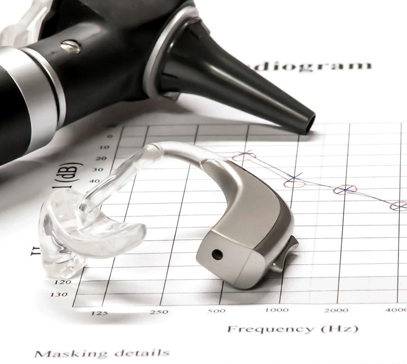 Hearing Aid Market Analysis, Size, and Forecast 2026-2030: Europe (Italy, Germany, and France), North America (US, Mexico, and Canada), Asia (Japan, China, and India), South America (Brazil, Argentina, and Colombia), Middle East and Africa (South Africa, Saudi Arabia, and Israel), Rest of World (ROW)