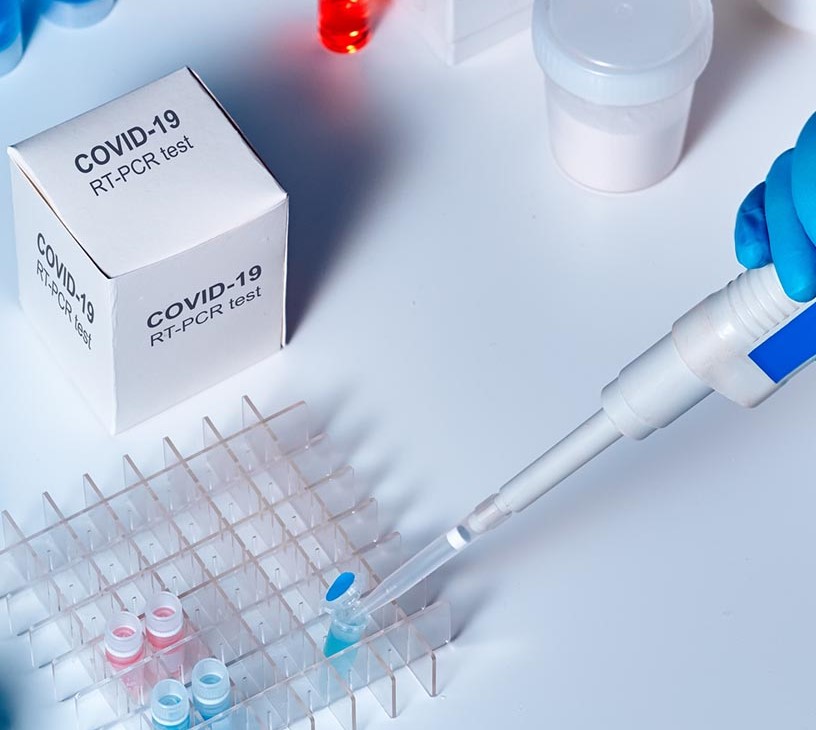 Coronavirus Test Kits Market Analysis, Size, and Forecast 2026-2030: APAC (China, India, and Japan), Europe (Germany, UK, and France), North America (US, Canada, and Mexico), South America (Brazil), Middle East and Africa (South Africa, UAE, and Saudi Arabia), Asia, Rest of World (ROW)