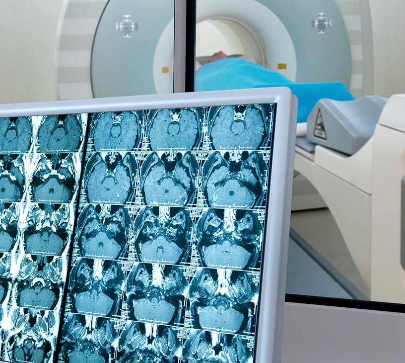 Picture Archiving And Communication System Market Analysis, Size, and Forecast 2026-2030: North America (US, Canada, and Mexico), Europe (Germany, UK, and France), APAC (China, Japan, and India), South America (Brazil, Argentina, and Colombia), Middle East and Africa (Saudi Arabia, UAE, and South Africa), Asia, Rest of World (ROW)