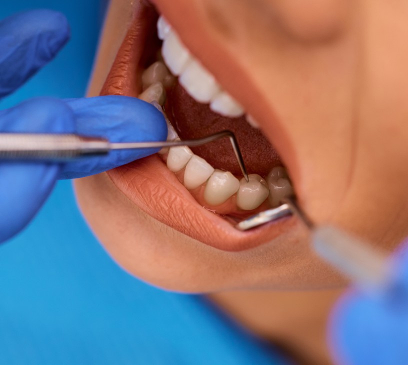Periodontal Dental Services Market Analysis, Size, and Forecast 2026-2030: North America (US, Canada, and Mexico), Europe (Germany, UK, and France), APAC (China, Japan, and India), South America (Brazil, Argentina, and Colombia), Middle East and Africa (UAE, South Africa, and Turkey), Asia, Rest of World (ROW)