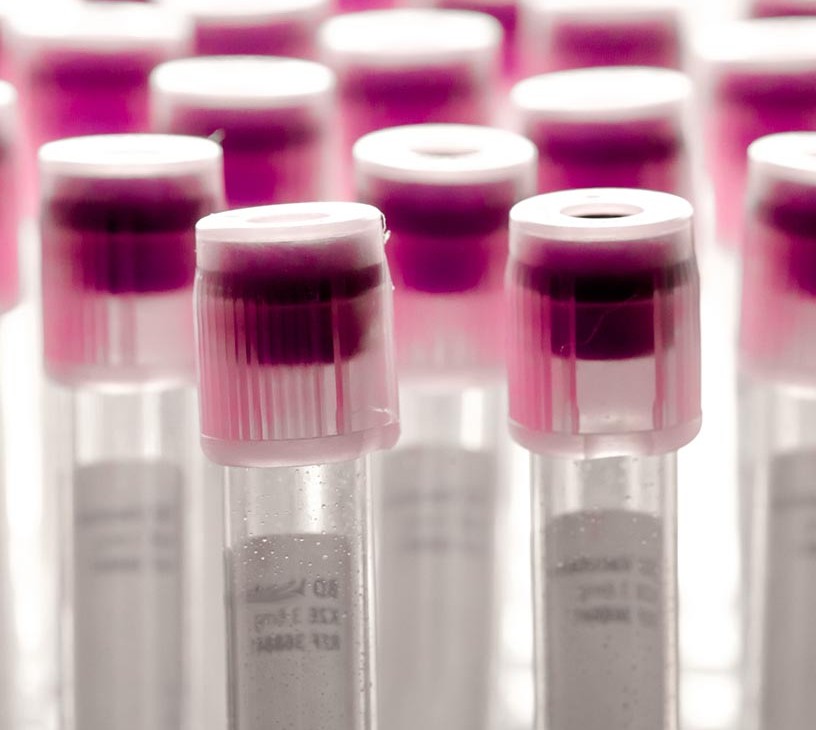 Industrial Enzymes Market Analysis, Size, and Forecast 2026-2030: North America (US, Canada, and Mexico), APAC (China, Japan, and India), Europe (Germany, UK, and France), South America (Brazil and Argentina), Middle East and Africa (South Africa, UAE, and Saudi Arabia), and Rest of World (ROW)