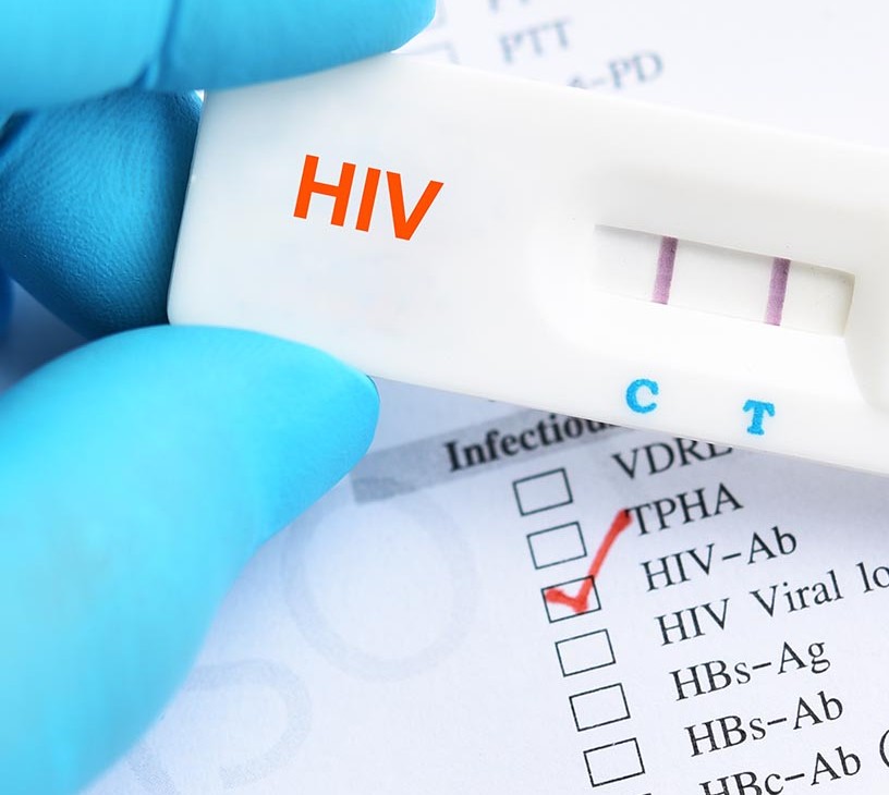Human Immunodeficiency Virus (HIV) Rapid Test Kits Market Analysis, Size, and Forecast 2026-2030: North America (US, Canada, and Mexico), Europe (Germany, UK, and France), Asia (China, India, and Japan), Middle East and Africa (South Africa, Saudi Arabia, and UAE), South America (Brazil, Argentina, and Colombia), Rest of World (ROW)