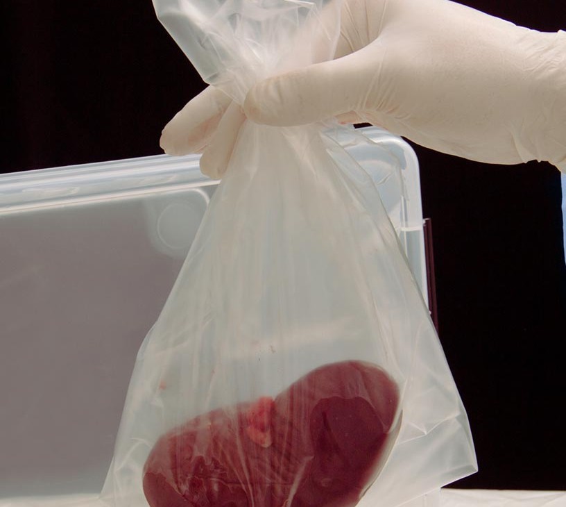 Preclinical Isolated Organ Perfusion System Market Analysis, Size, and Forecast 2026-2030: North America (US, Canada, and Mexico), Europe (Germany, UK, and France), Asia (China, Japan, and India), Middle East and Africa (Saudi Arabia, UAE, and South Africa), South America (Brazil and Colombia), Rest of World (ROW)