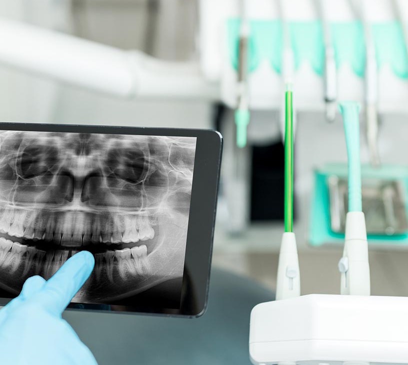 Dental Radiology Equipment Market Analysis, Size, and Forecast 2026-2030: North America (US, Canada, and Mexico), Europe (Germany, UK, and France), APAC (China, India, and Japan), South America (Brazil and Argentina), Middle East and Africa (Saudi Arabia, UAE, and Turkey), Asia, Rest of World (ROW)