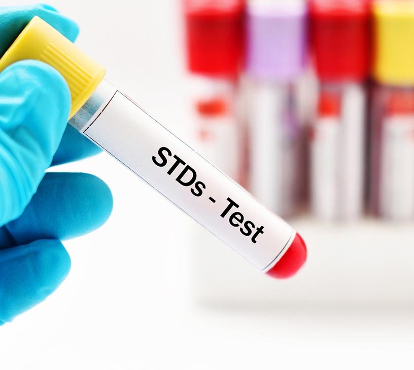 Sexually Transmitted Disease (STD) Testing Market Analysis, Size, and Forecast 2026-2030: North America (US, Canada, and Mexico), Europe (Germany, UK, and France), APAC (China, Japan, and India), South America (Brazil, Argentina, and Colombia), Middle East and Africa (South Africa, Saudi Arabia, and UAE), Asia, Rest of World (ROW)