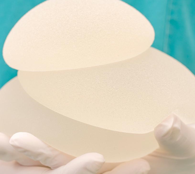 Breast Implant Market Analysis, Size, and Forecast 2026-2030: North America (US, Canada, and Mexico), Europe (Germany, France, and UK), APAC (China, Japan, and South Korea), South America (Brazil, Colombia, and Argentina), Middle East and Africa (South Africa, UAE, and Turkey), Asia, Rest of World (ROW)
