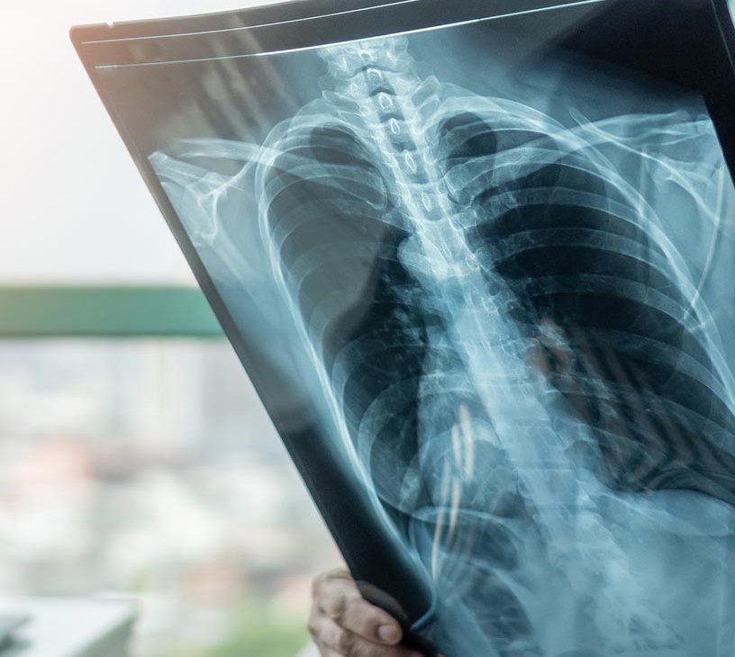 Chronic Obstructive Pulmonary Disease Drugs Market Analysis, Size, and Forecast 2026-2030: North America (US, Canada, and Mexico), Europe (Germany, UK, and France), APAC (China, Japan, and India), Middle East and Africa (UAE, South Africa, and Saudi Arabia), South America (Brazil), Asia, Rest of World (ROW)