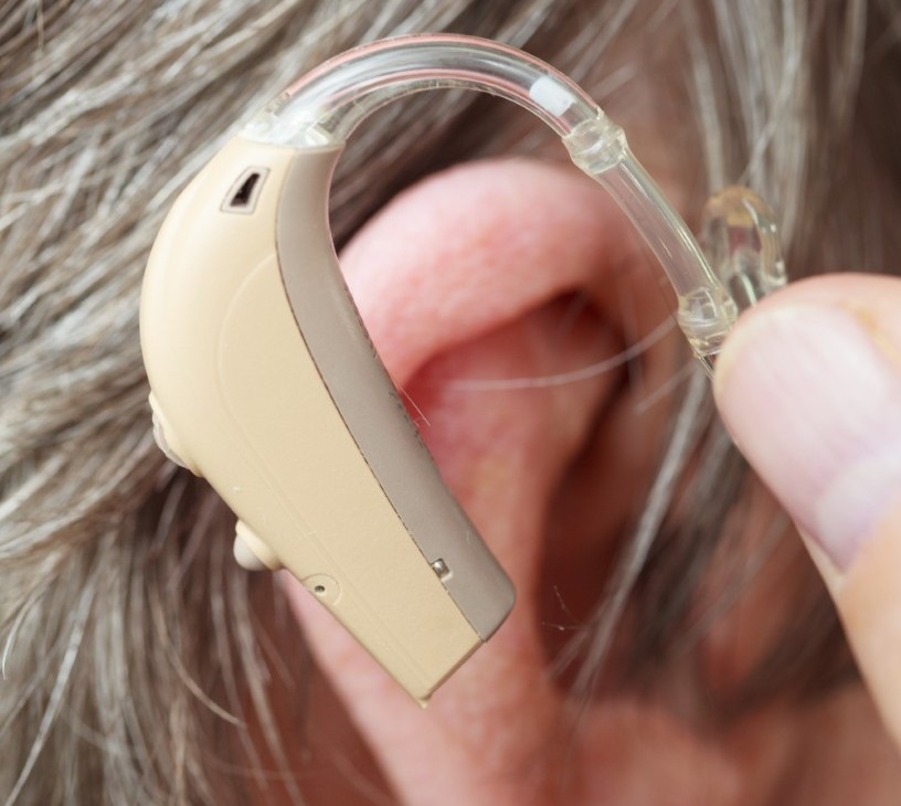 Bone Conduction Devices Market Analysis, Size, and Forecast 2026-2030: North America (US, Canada, and Mexico), Europe (Germany, UK, and France), Asia (China, India, and Japan), South America (Brazil, Argentina, and Colombia), Middle East and Africa (Saudi Arabia, UAE, and Turkey), Rest of World (ROW)