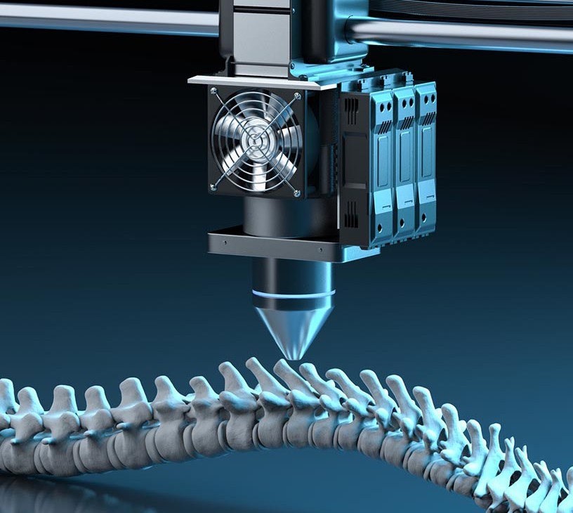 Extremity Products Market Analysis, Size, and Forecast 2026-2030: North America (US, Canada, and Mexico), Europe (Germany, UK, and France), APAC (China, Japan, and India), Middle East and Africa (UAE, Saudi Arabia, and South Africa), South America (Brazil), Asia, Rest of World (ROW)