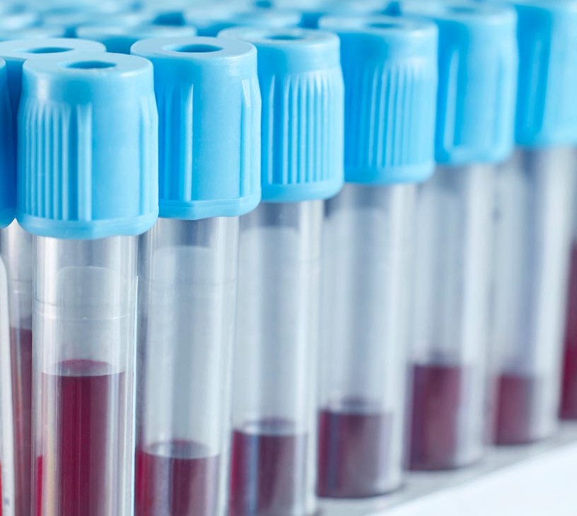 Pharmaceutical Cartridges Market Analysis, Size, and Forecast 2026-2030: North America (US, Canada, and Mexico), Europe (Germany, UK, and France), APAC (China, Japan, and India), South America (Brazil, Argentina, and Colombia), Middle East and Africa (Saudi Arabia, UAE, and South Africa), Asia, Rest of World (ROW)