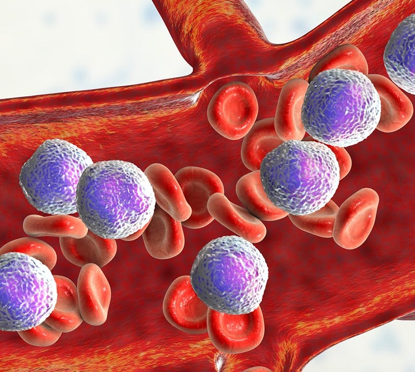 APAC Acute Myeloid Leukemia (AML) Treatment Market Analysis, Size, and Forecast 2026-2030: APAC (China, Japan, and India)