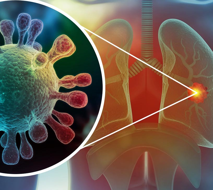 Bronchitis Treatment Market Analysis, Size, and Forecast 2026-2030: North America (US, Canada, and Mexico), Europe (Germany, UK, and France), APAC (China, India, and Japan), South America (Brazil, Argentina, and Colombia), Middle East and Africa (Saudi Arabia, UAE, and South Africa), Asia, Rest of World (ROW)