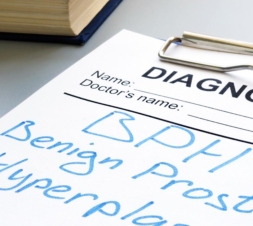 Benign Prostatic Hyperplasia (BPH) Devices Market Analysis, Size, and Forecast 2026-2030: North America (US, Canada, and Mexico), Europe (Germany, UK, and France), APAC (China, Japan, and India), South America (Brazil and Argentina), Middle East and Africa (Saudi Arabia, UAE, and Turkey), Asia, Rest of World (ROW)