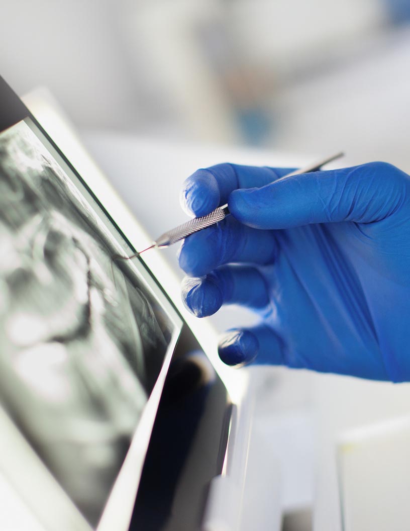 Buccal Cavity Devices Market: Segmentation by Geography