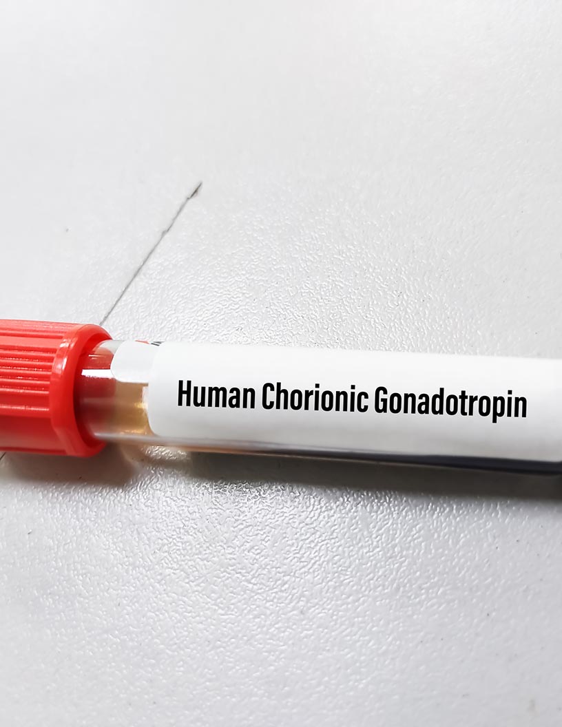 Human Chorionic Gonadotropin (HCG) Market Analysis, Size, and Forecast 2025-2029: North America (US, Canada, and Mexico), Europe (Germany, UK, and France), APAC (China, Japan, and India), South America (Brazil, Argentina, and Colombia), Middle East and Africa (Saudi Arabia, UAE, and South Africa), Asia, Rest of World (ROW)