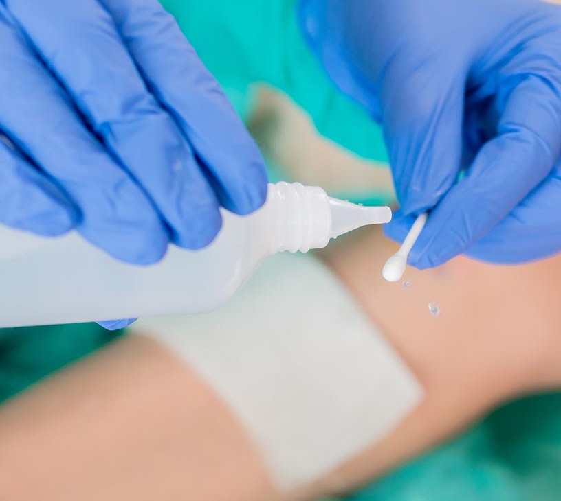 Bioactive Wound Dressing Market Analysis, Size, and Forecast 2026-2030: North America (US, Canada, and Mexico), Europe (Germany, UK, and France), APAC (China, India, and Japan), South America (Brazil, Argentina, and Colombia), Middle East and Africa (Saudi Arabia, UAE, and Turkey), Asia, Rest of World (ROW)
