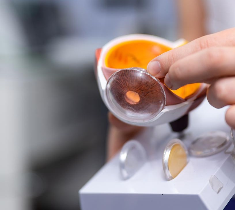 Ocular Implants Market Analysis, Size, and Forecast 2025-2029: North America (US, Canada, and Mexico), Europe (Germany, UK, and France), APAC (China, Japan, and India), South America (Brazil, Argentina, and Colombia), Middle East and Africa (Saudi Arabia, UAE, and South Africa), Asia, Rest of World (ROW)