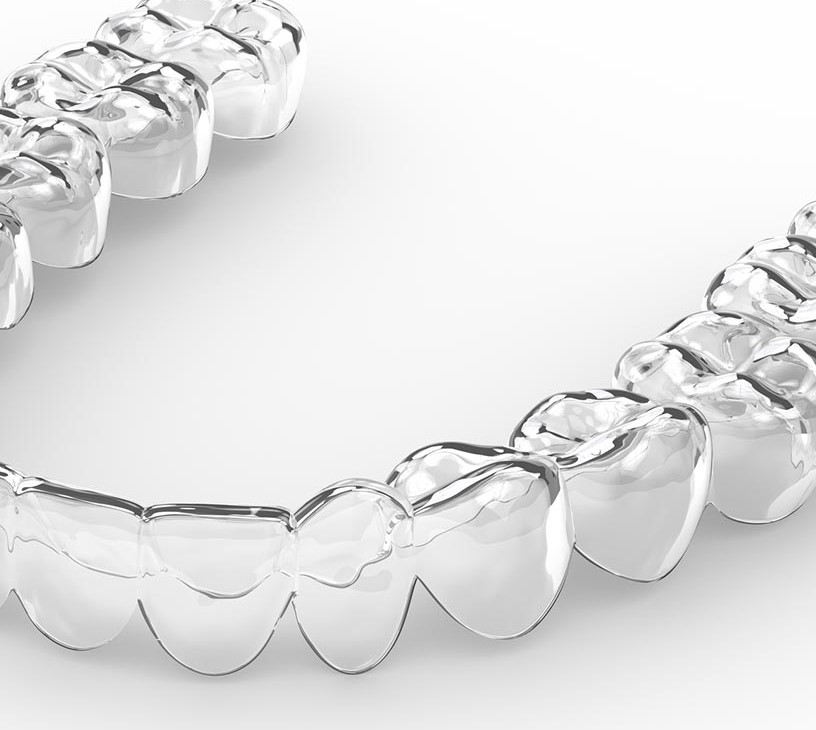 Dental Braces Market Analysis, Size, and Forecast 2026-2030: North America (US, Canada, and Mexico), Europe (Germany, UK, and France), APAC (China, Japan, and India), South America (Brazil, Argentina, and Colombia), Middle East and Africa (South Africa, Saudi Arabia, and UAE), Asia, Rest of World (ROW)