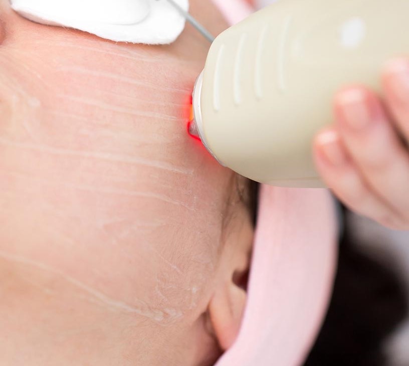 Aesthetic Devices Market Analysis, Size, and Forecast 2026-2030: North America (US, Canada, and Mexico), Europe (Germany, France, and UK), APAC (China, South Korea, and Japan), Middle East and Africa (UAE, South Africa, and Saudi Arabia), South America (Brazil), Asia, Rest of World (ROW)