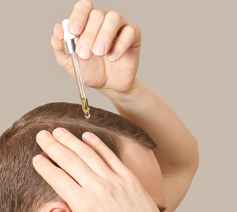 Hair Loss Treatment Products Market Analysis, Size, and Forecast 2026-2030: APAC (China, Japan, and South Korea), North America (US, Canada, and Mexico), Europe (Germany, UK, and France), South America (Brazil, Argentina, and Colombia), Middle East and Africa (Saudi Arabia, South Africa, and UAE), and Rest of World (ROW)