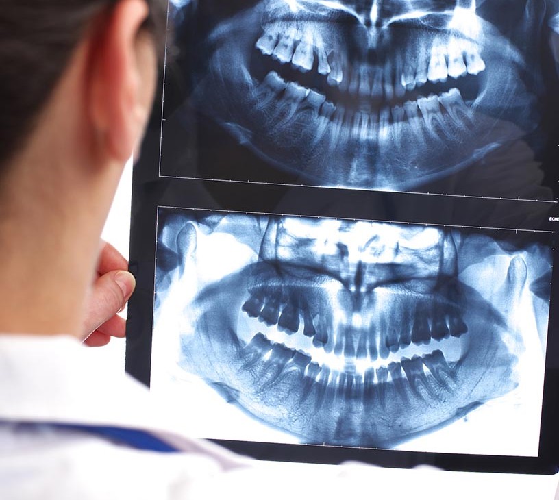 Dental Imaging Market Analysis, Size, and Forecast 2026-2030: North America (US, Canada, and Mexico), APAC (China, Japan, and India), Europe (Germany, UK, and France), South America (Brazil and Argentina), Middle East and Africa (Saudi Arabia, South Africa, and Turkey), Asia, Rest of World (ROW)