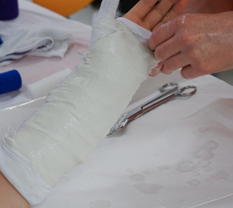 Bone Cement Glue Market Analysis, Size, and Forecast 2026-2030: North America (US, Canada, and Mexico), Europe (Germany, UK, and France), APAC (China, India, and Japan), South America (Brazil, Argentina, and Colombia), Middle East and Africa (Saudi Arabia, UAE, and Turkey), Asia, Rest of World (ROW)