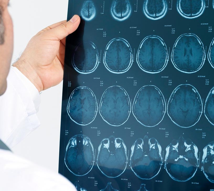 Computed Tomography (CT) Market Analysis, Size, and Forecast 2026-2030: Europe (Germany, UK, and France), North America (US, Canada, and Mexico), APAC (China, Japan, and India), South America (Brazil, Argentina, and Colombia), Middle East and Africa (Saudi Arabia, South Africa, and UAE), Asia, Rest of World (ROW)