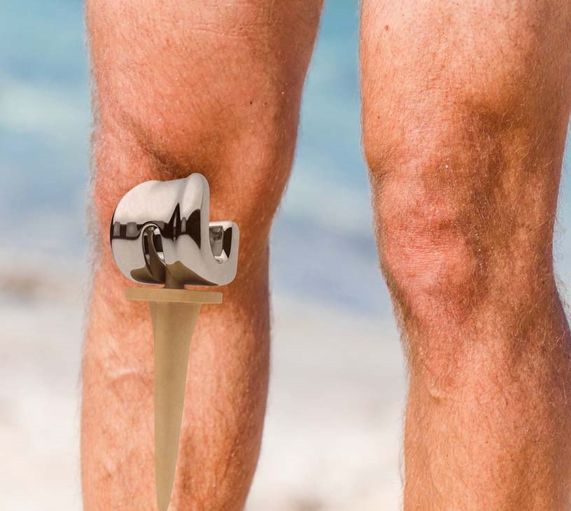 Endoprosthesis Market Analysis, Size, and Forecast 2026-2030: North America (US, Canada, and Mexico), Europe (Germany, UK, and France), APAC (China, Japan, and India), South America (Brazil and Argentina), Middle East and Africa (Turkey, South Africa, and UAE), Asia, Rest of World (ROW)