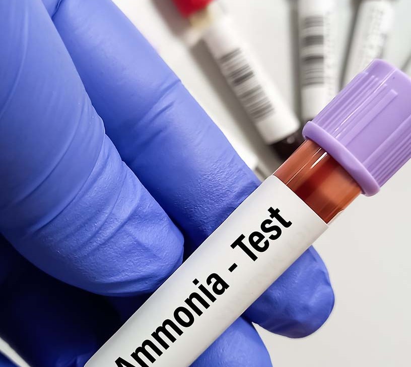 Urea Cycle Disorder Treatment Market Analysis, Size, and Forecast 2026-2030: North America (US, Canada, and Mexico), Europe (Germany, UK, and France), APAC (China, Japan, and India), South America (Brazil, Argentina, and Colombia), Middle East and Africa (Saudi Arabia, UAE, and Turkey), Asia, Rest of World (ROW)