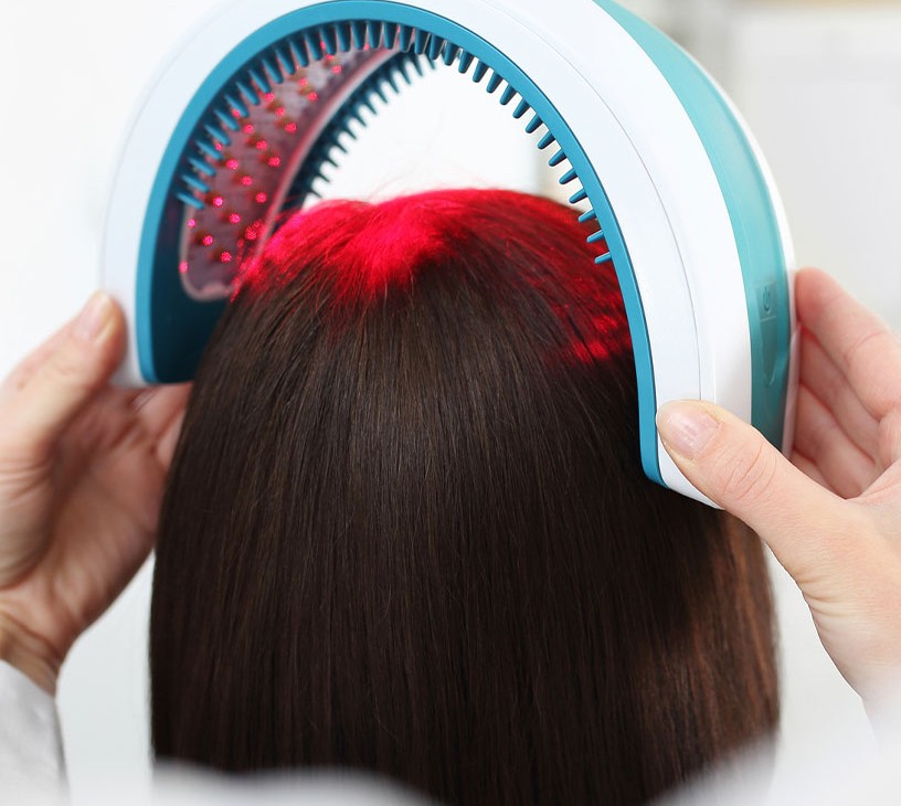 Laser Hair Loss Treatment Market Analysis, Size, and Forecast 2026-2030: North America (US, Canada, and Mexico), Europe (Germany, UK, and France), APAC (China, Japan, and India), South America (Brazil, Argentina, and Colombia), Middle East and Africa (Saudi Arabia, UAE, and Israel), and Rest of World (ROW)