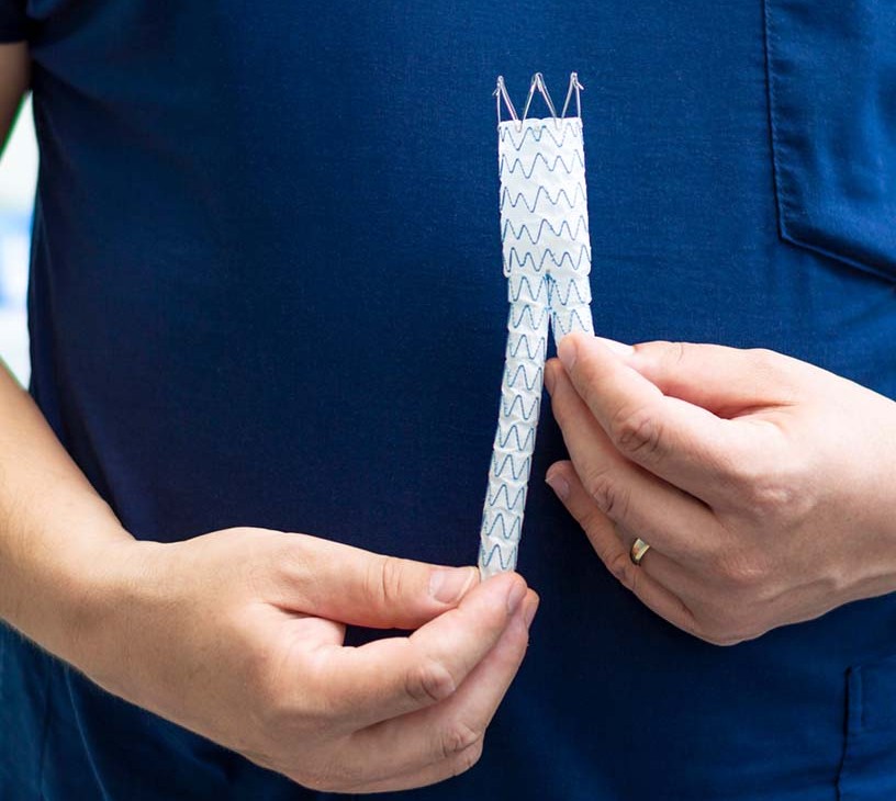 Endovascular Abdominal Aortic Aneurysm (AAA) Repair Devices Market Analysis, Size, and Forecast 2026-2030: North America (US, Canada, and Mexico), Europe (Germany, UK, and France), APAC (China, India, and Japan), South America (Brazil, Argentina, and Colombia), Middle East and Africa (Saudi Arabia, UAE, and Turkey), Asia, Rest of World (ROW)