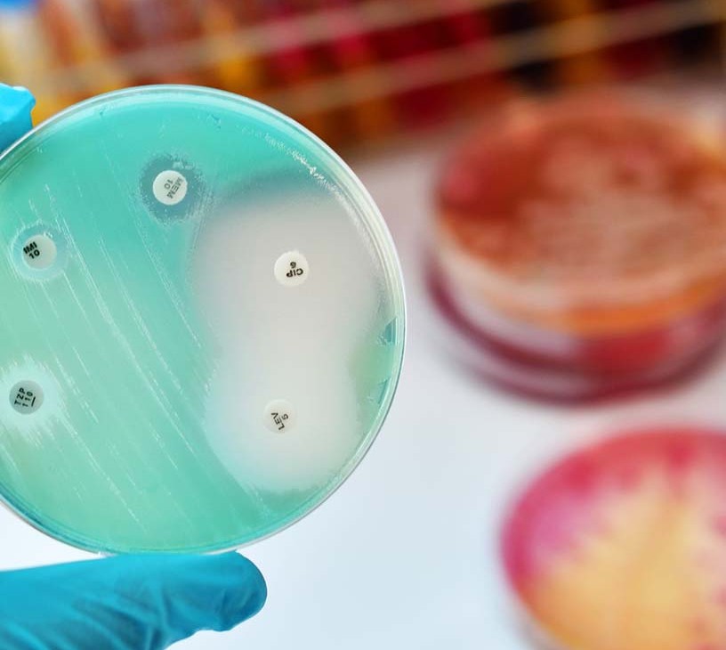 Fungal Keratitis Treatment Market Analysis, Size, and Forecast 2026-2030: North America (US, Canada, and Mexico), Europe (Germany, UK, and France), APAC (China, Japan, and India), Middle East and Africa (UAE, South Africa, and Saudi Arabia), South America (Brazil), Asia, Rest of World (ROW)