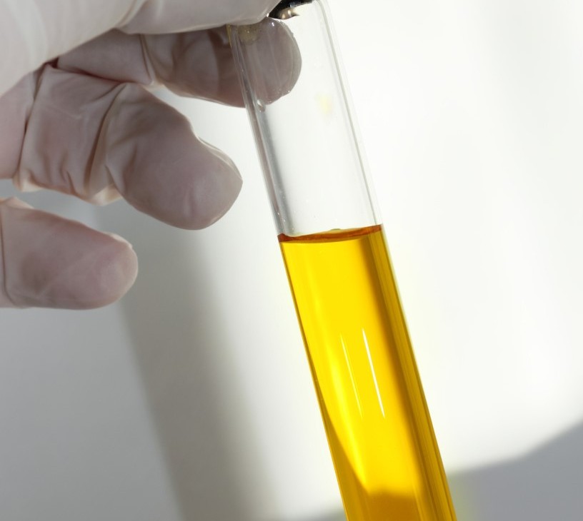 Human Platelet Lysate Market Analysis, Size, and Forecast 2026-2030: North America (US, Canada, and Mexico), Europe (Germany, France, and UK), APAC (China, Japan, and India), South America (Brazil, Argentina, and Colombia), Middle East and Africa (Saudi Arabia, South Africa, and UAE), Asia, Rest of World (ROW)