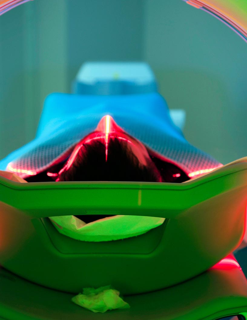 Global head and neck cancer diagnostics market 2024-2028