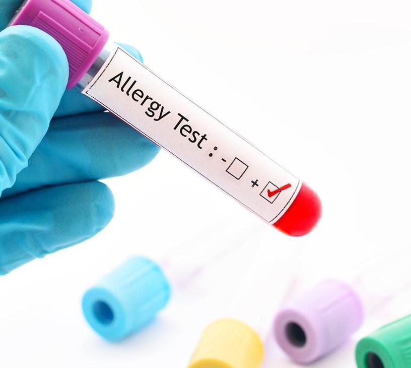 Global Allergy Rhinitis Drugs Market 2025-2029