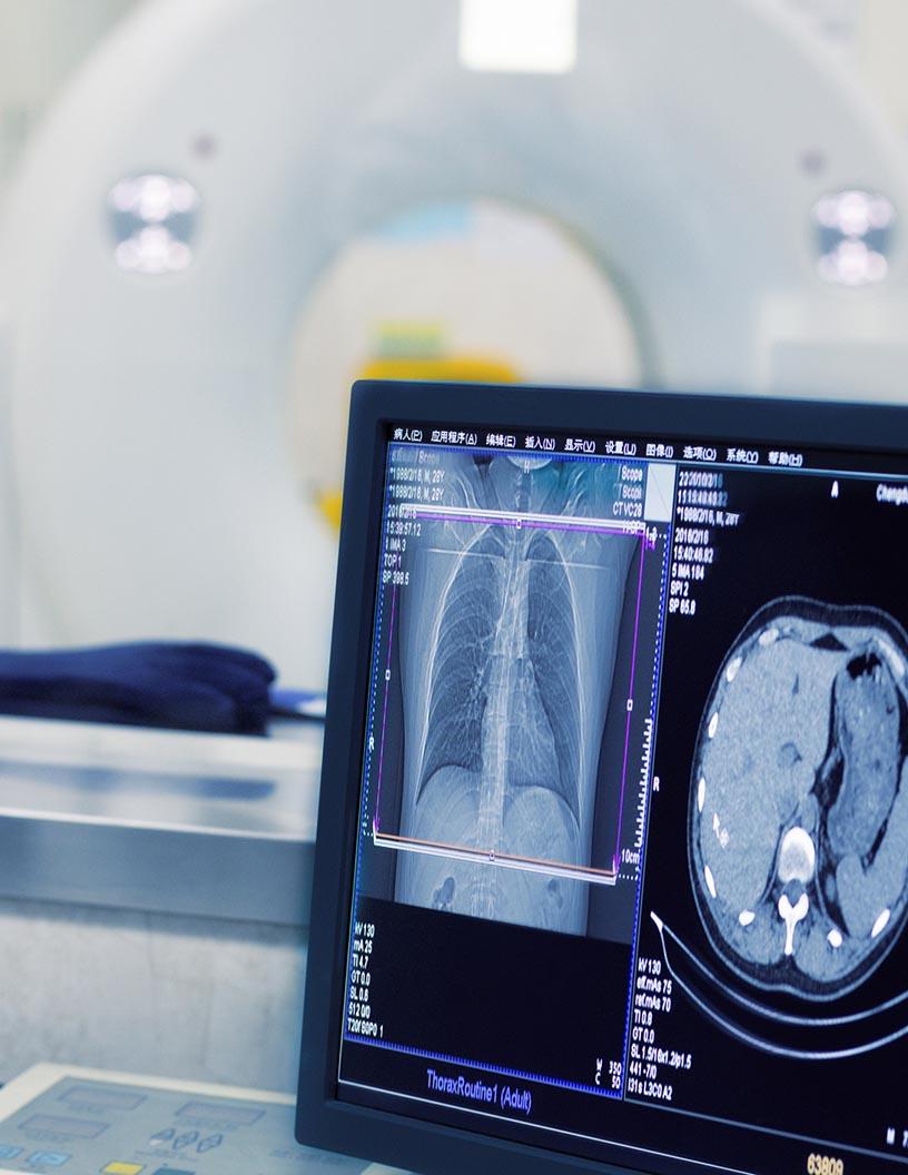 Global Medical Imaging Market 2025-2029