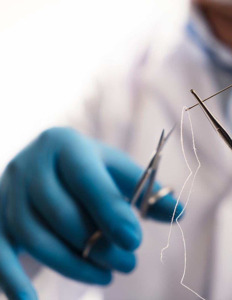 Global surgical sutures market 2024-2028