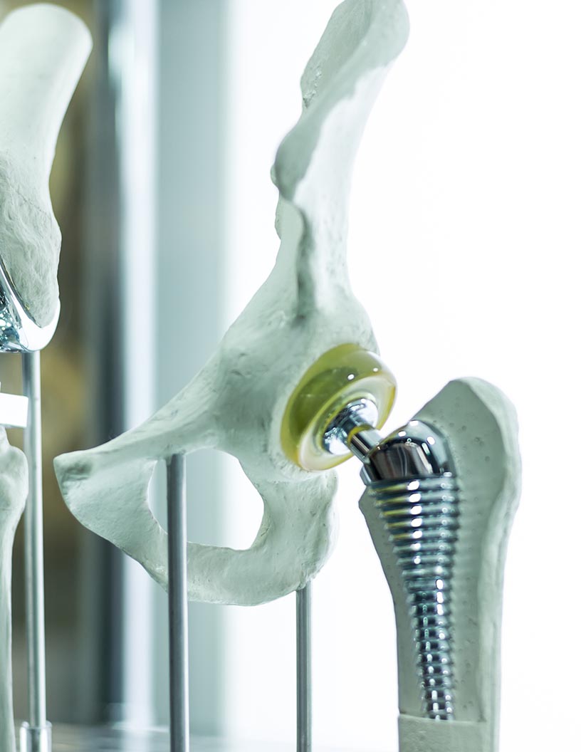 Global orthopedic surgical robots market 2024-2028