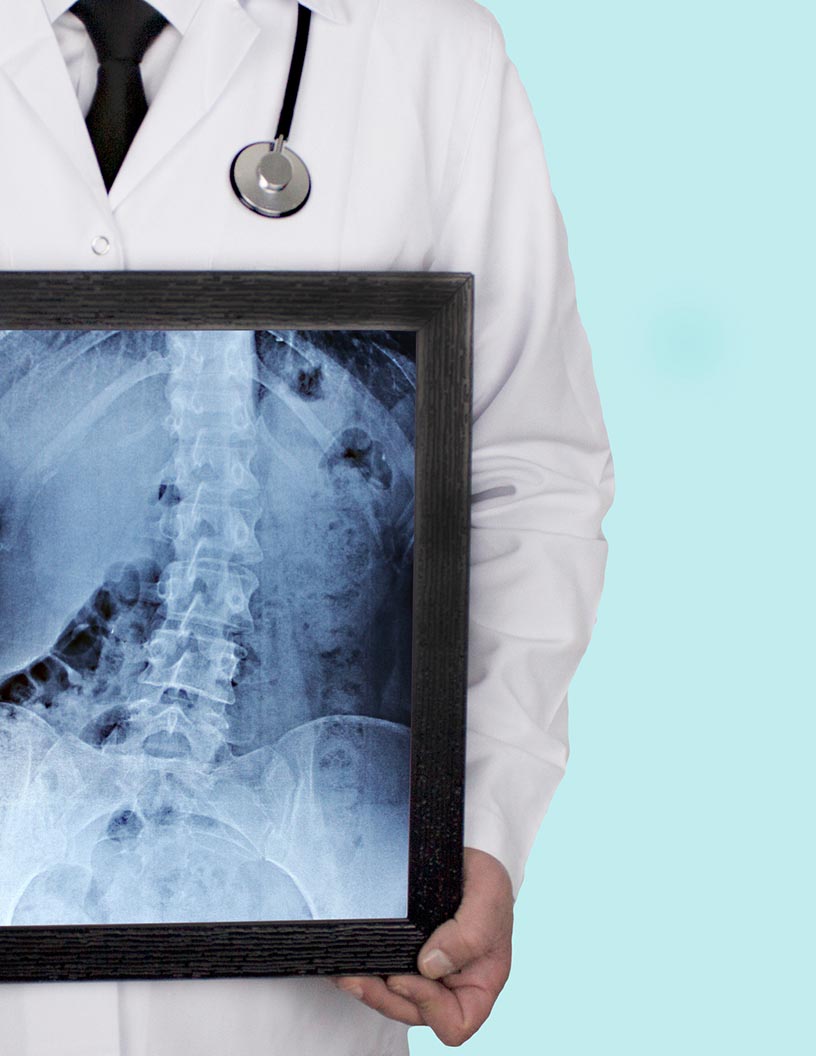 Global Advanced X-Ray Visualization Systems Market 2024-2028