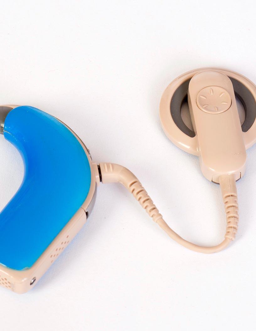 Global Cochlear Implants Market 2025-2029