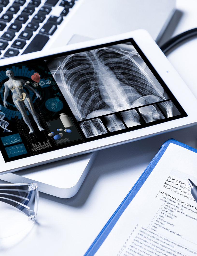 Global endoscopic mucosal resection devices market 2024-2028