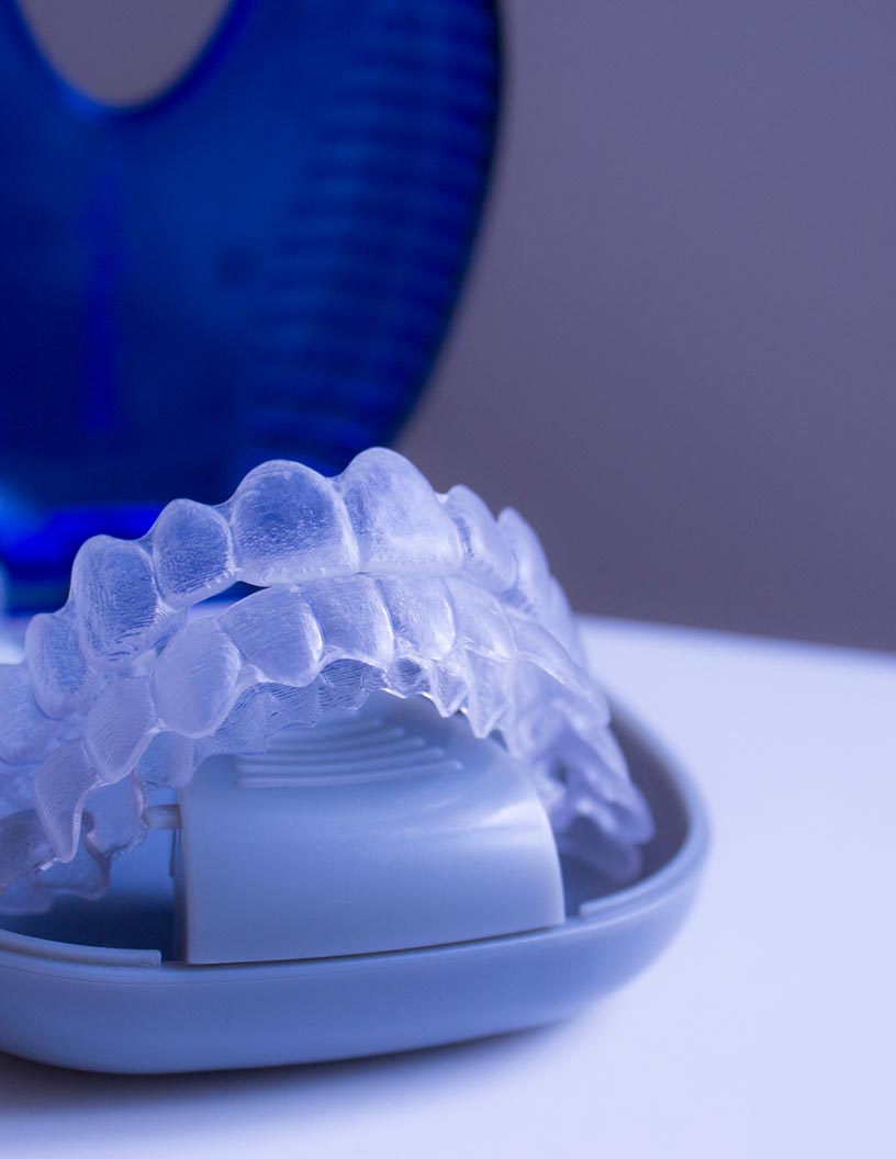Invisible Orthodontics Market in China 2024-2028