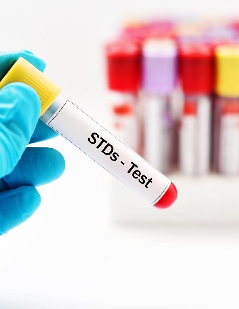 Global sexually transmitted disease (STD) Testing market 2024-2028
