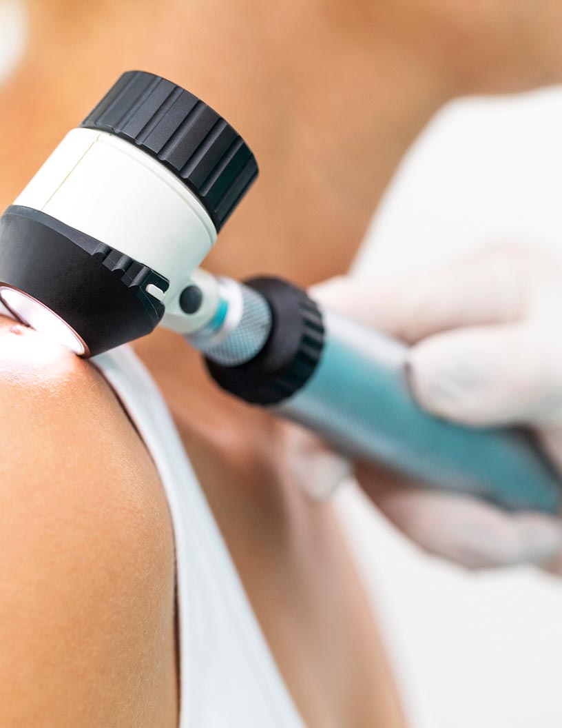 Global dermatology diagnostic devices market 2024-2028