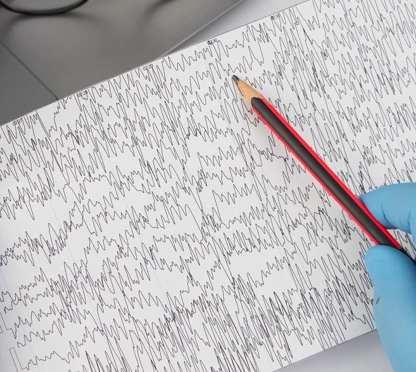 Global Electrophysiology Market 2025-2029