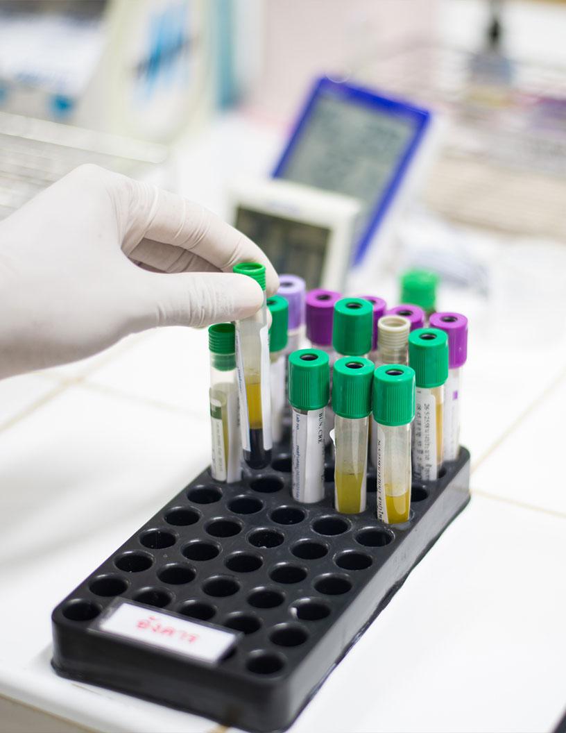 Global In-Vitro Diagnostics (IVD) Market 2025-2029