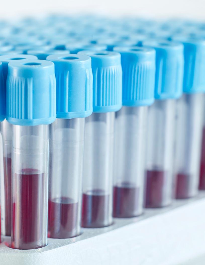 Global Pharmaceutical Cartridges Market 2024-2028