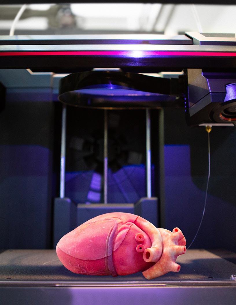 Artificial Organs And Bionic Implants Market in Spain 2024-2028